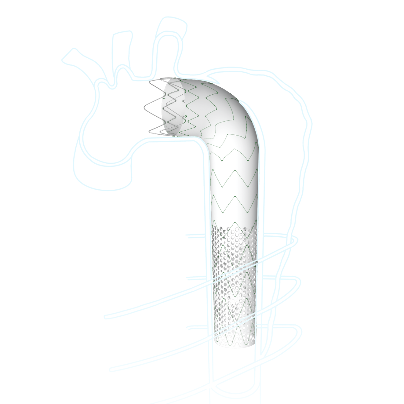 Talos? Thoracic Stent Graft System